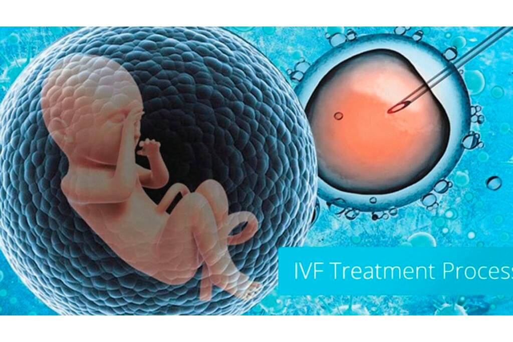 infertility-treatment