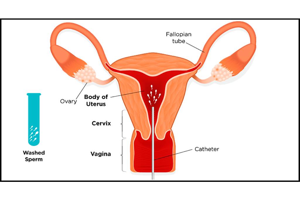 Glaucoma examination and treatment